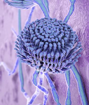 Mycotoxins and chronic illness.